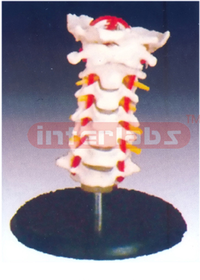 Cervical Vertebra Coloumn with Neck Artery, Occipital, hemiated disc and nerves